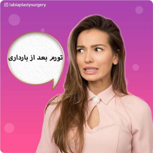 تورم بعد از بارداری