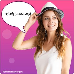 تورم بعد از بارداری