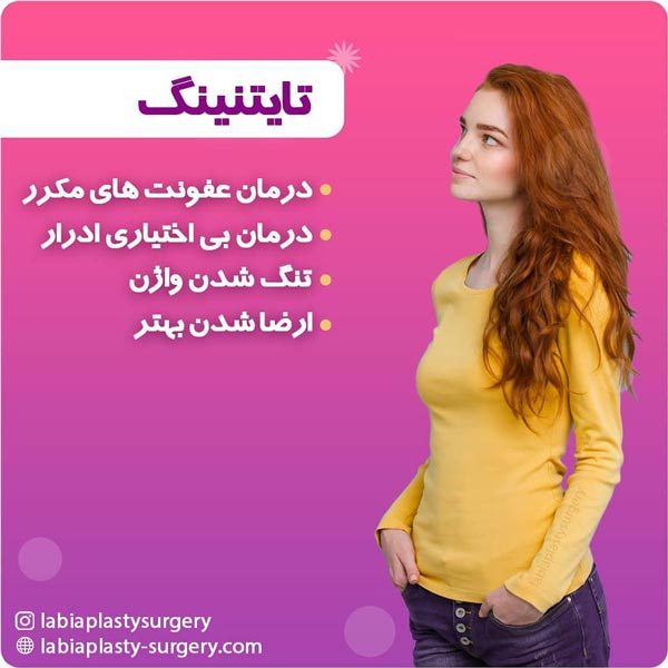 تایتنینگ