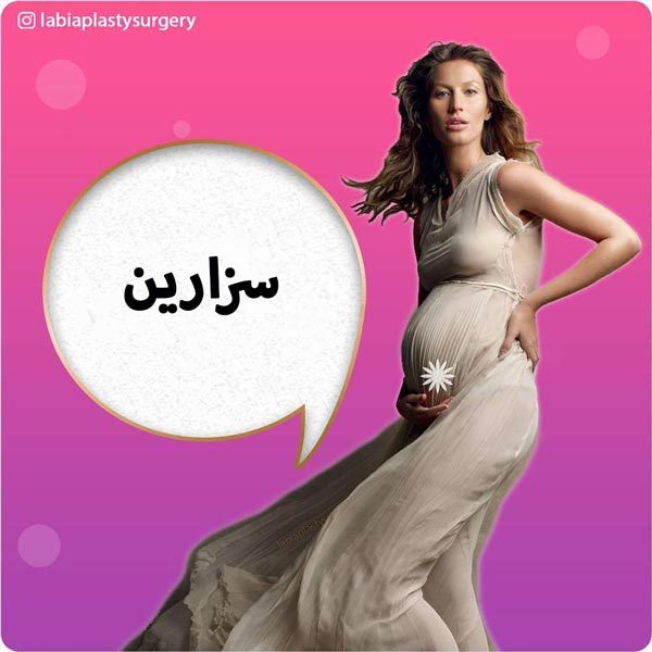 سزارین