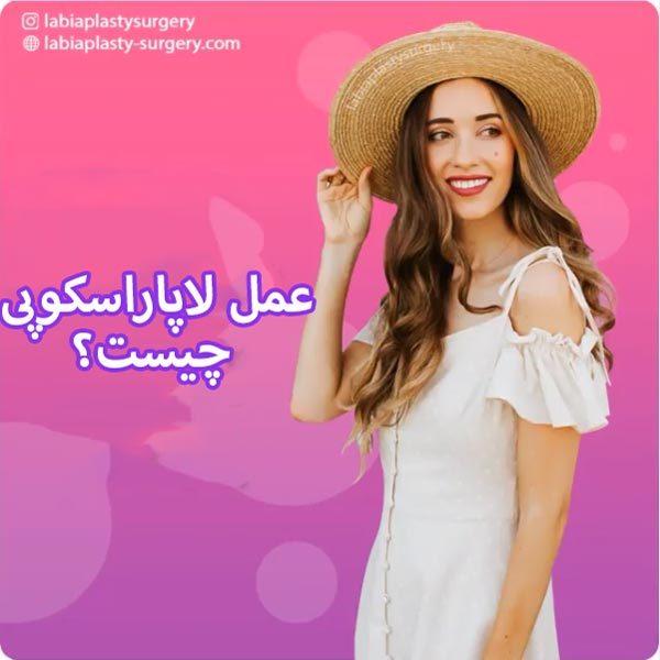لاپاراسکوپی